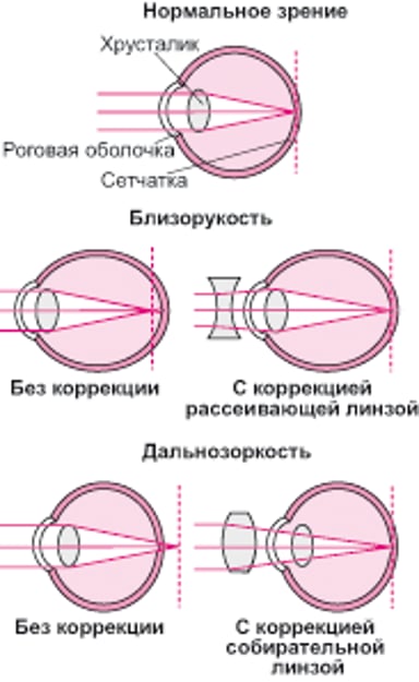 Что такое рефракция