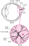 망막 보기