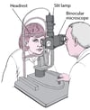 What Is a Slit Lamp?