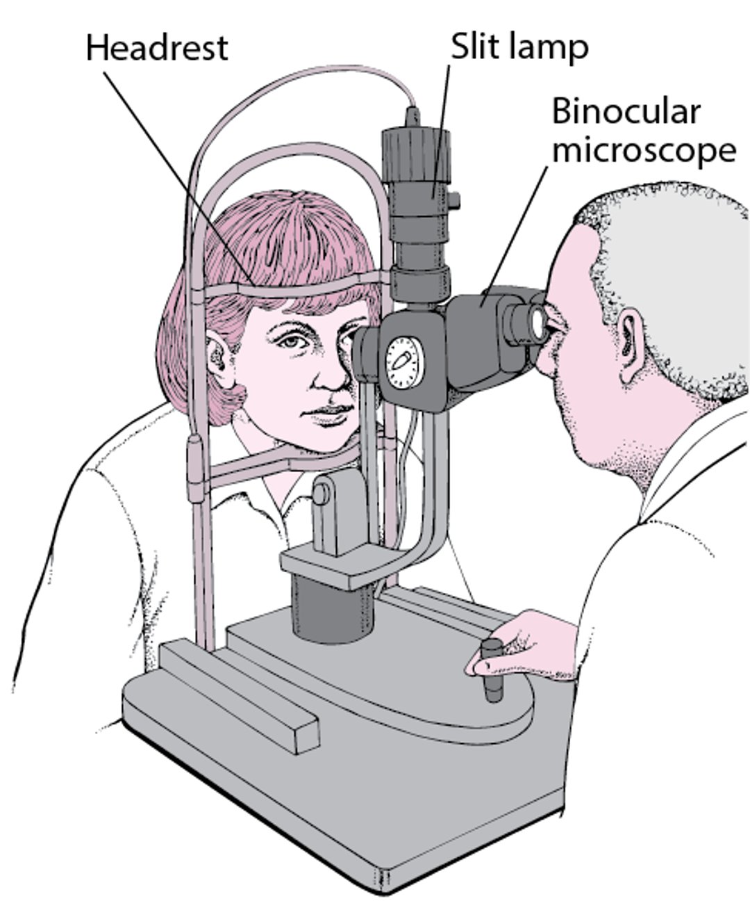 What Is a Slit Lamp?