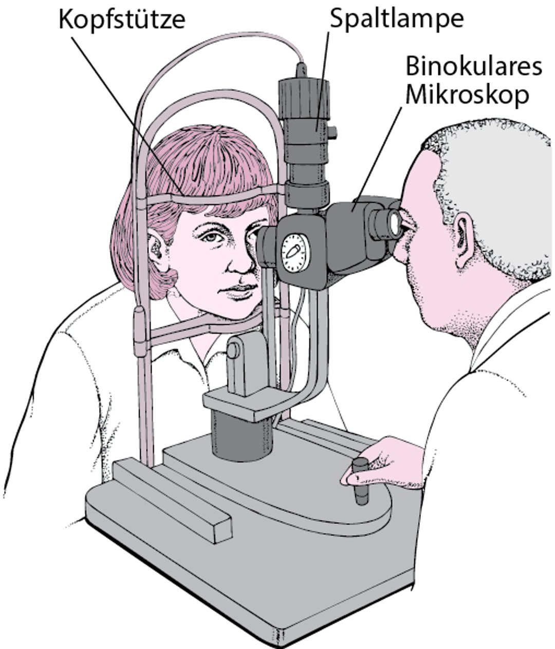 Was ist eine Spaltlampe?