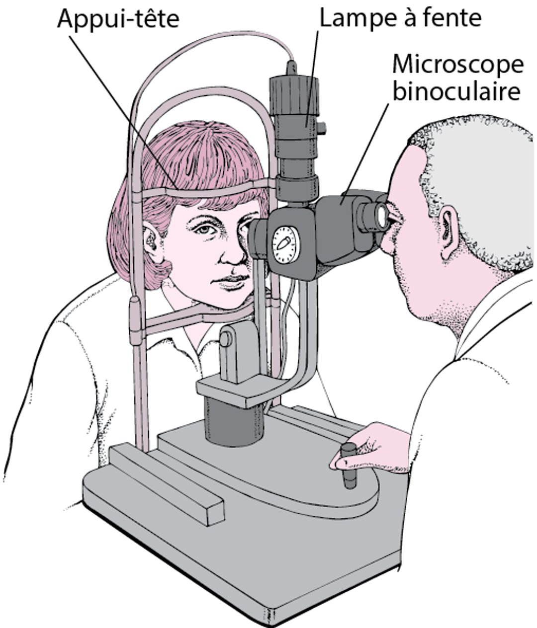 Qu’est-ce qu’une lampe à fente ?
