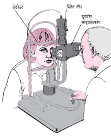 स्लिट लैंप क्या होता है?