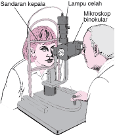 Apa yang Dimaksud dengan Lampu Celah?