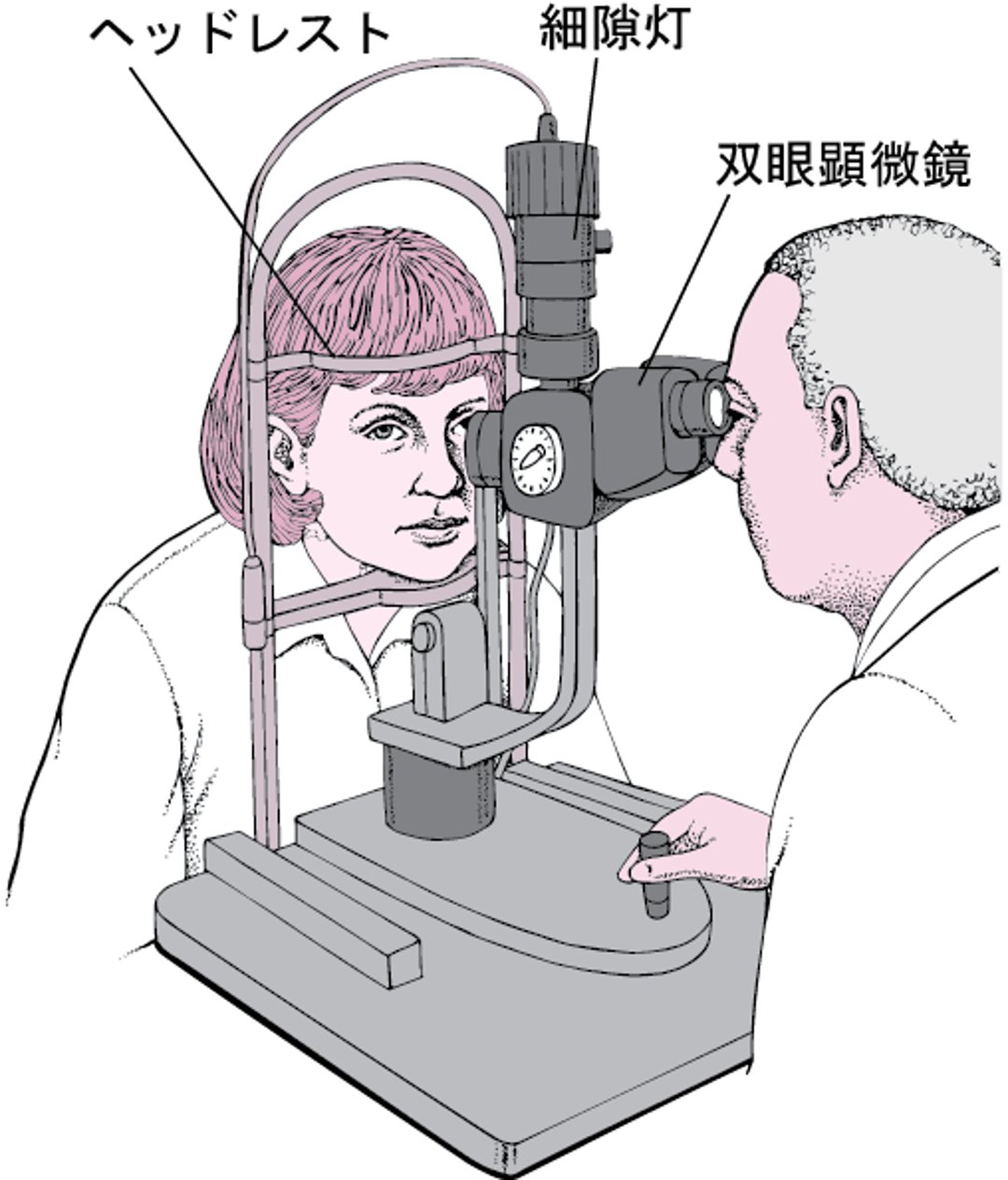 細隙灯とは
