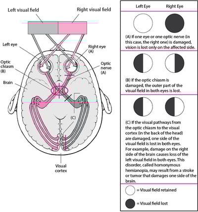 Visual Pathways and the Consequences of Damage