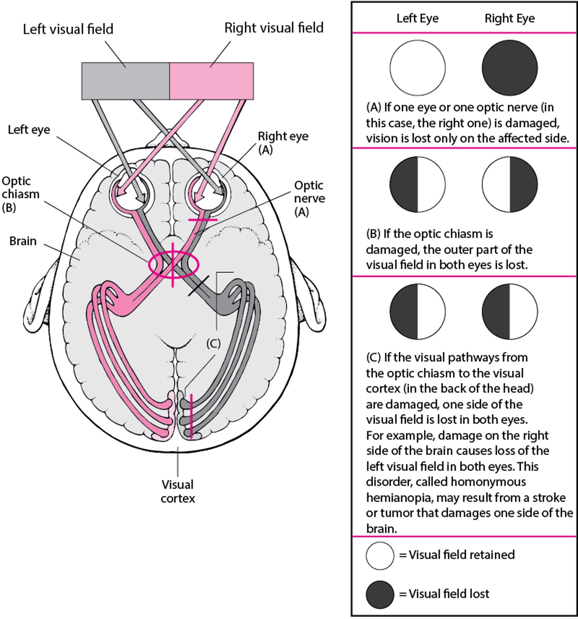 Visual Pathways and the Consequences of Damage