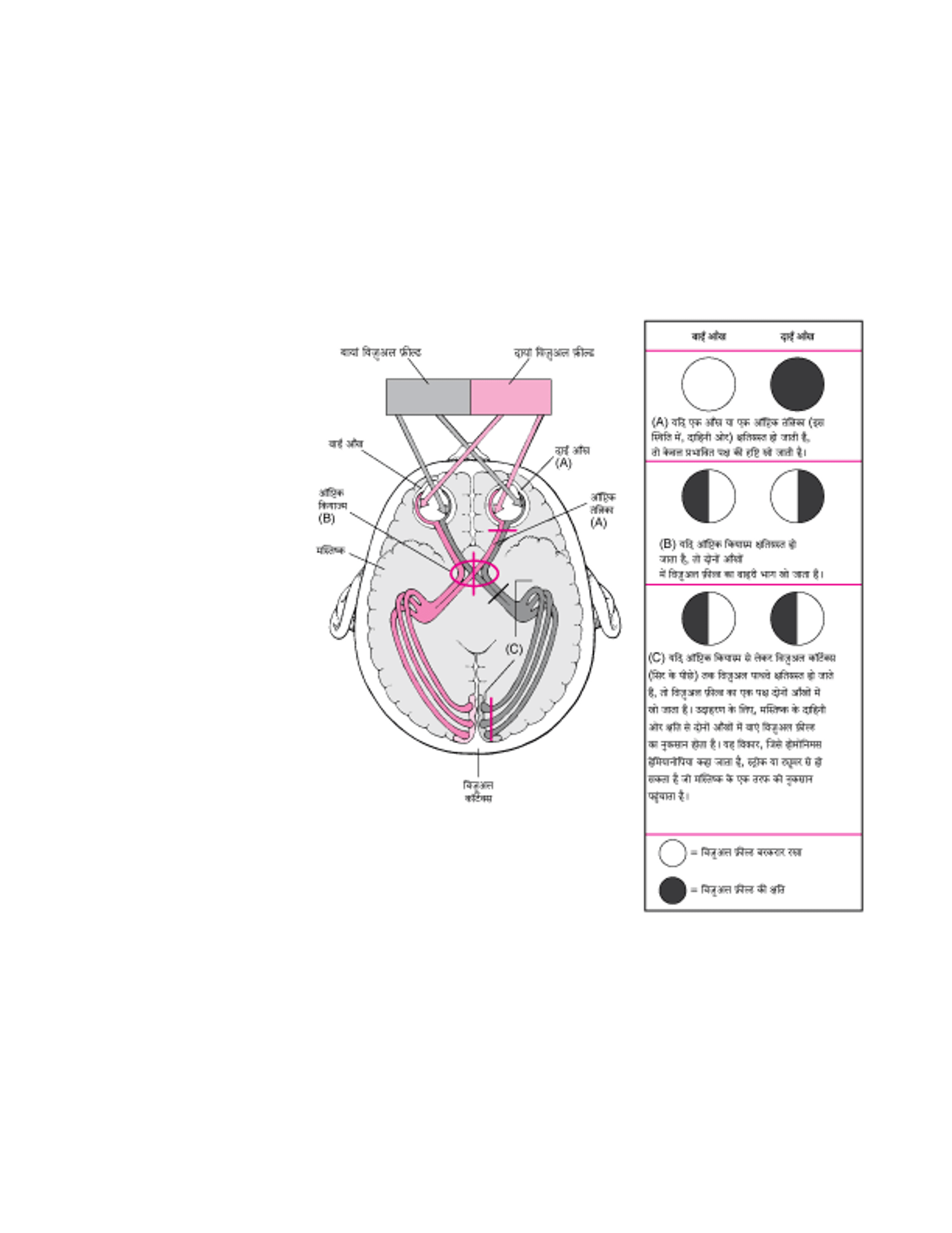 दृष्टि के पाथवे और क्षति के परिणाम