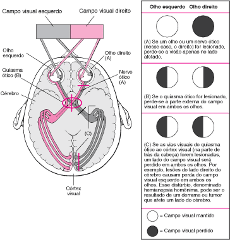 As vias visuais e as consequências da lesão