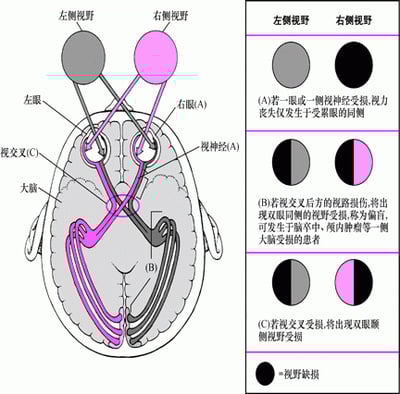 当视觉通路受损时