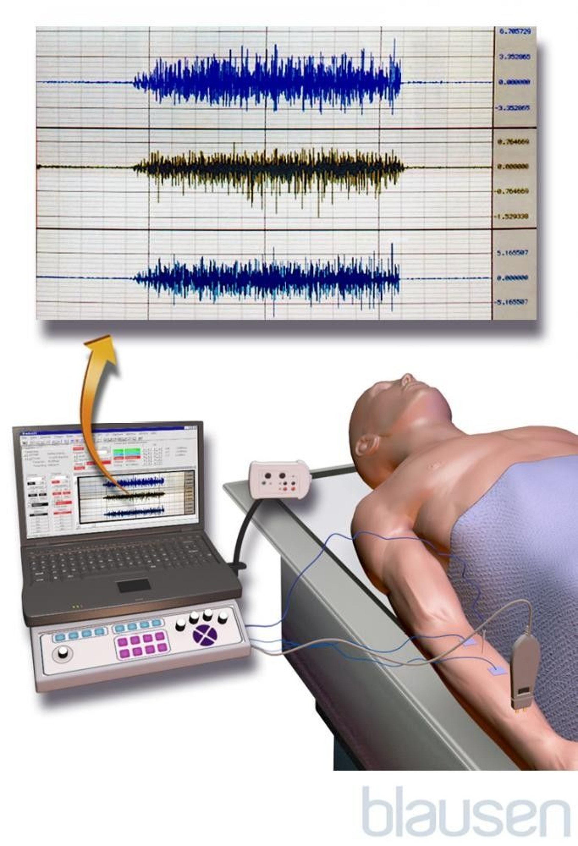 signals travel down the spinal cord to the muscles