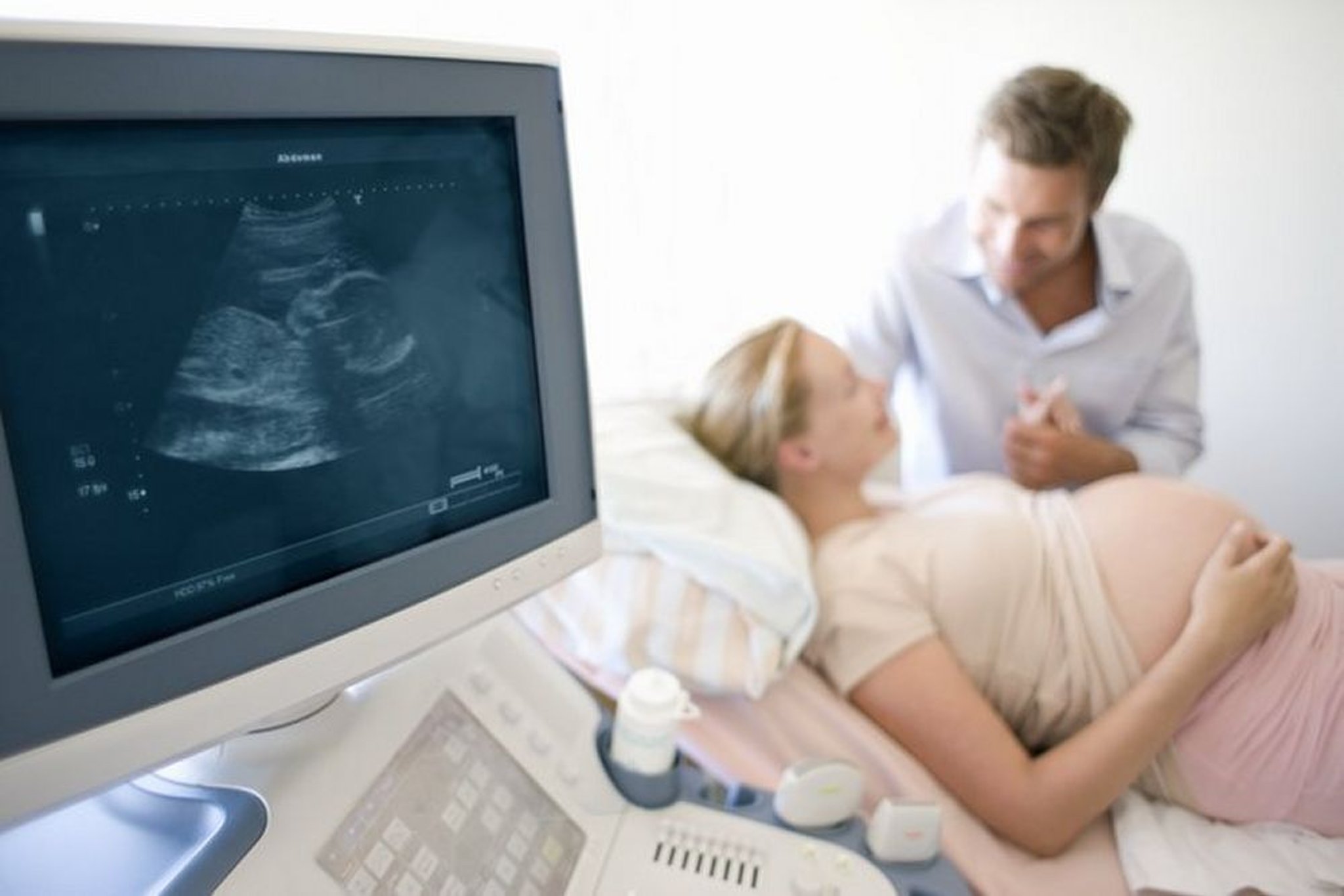 胎児の超音波画像