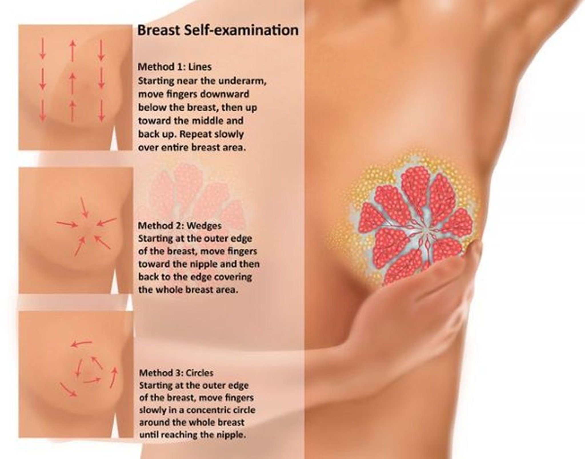 Breast Self-Examination