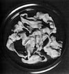 Fish Tapeworm