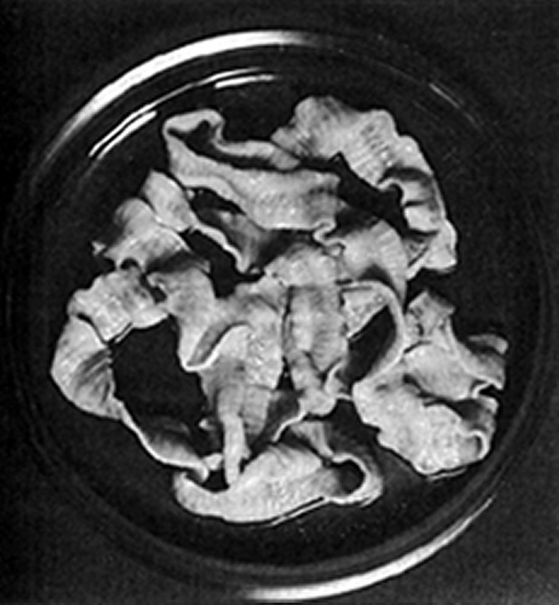 鱼绦虫