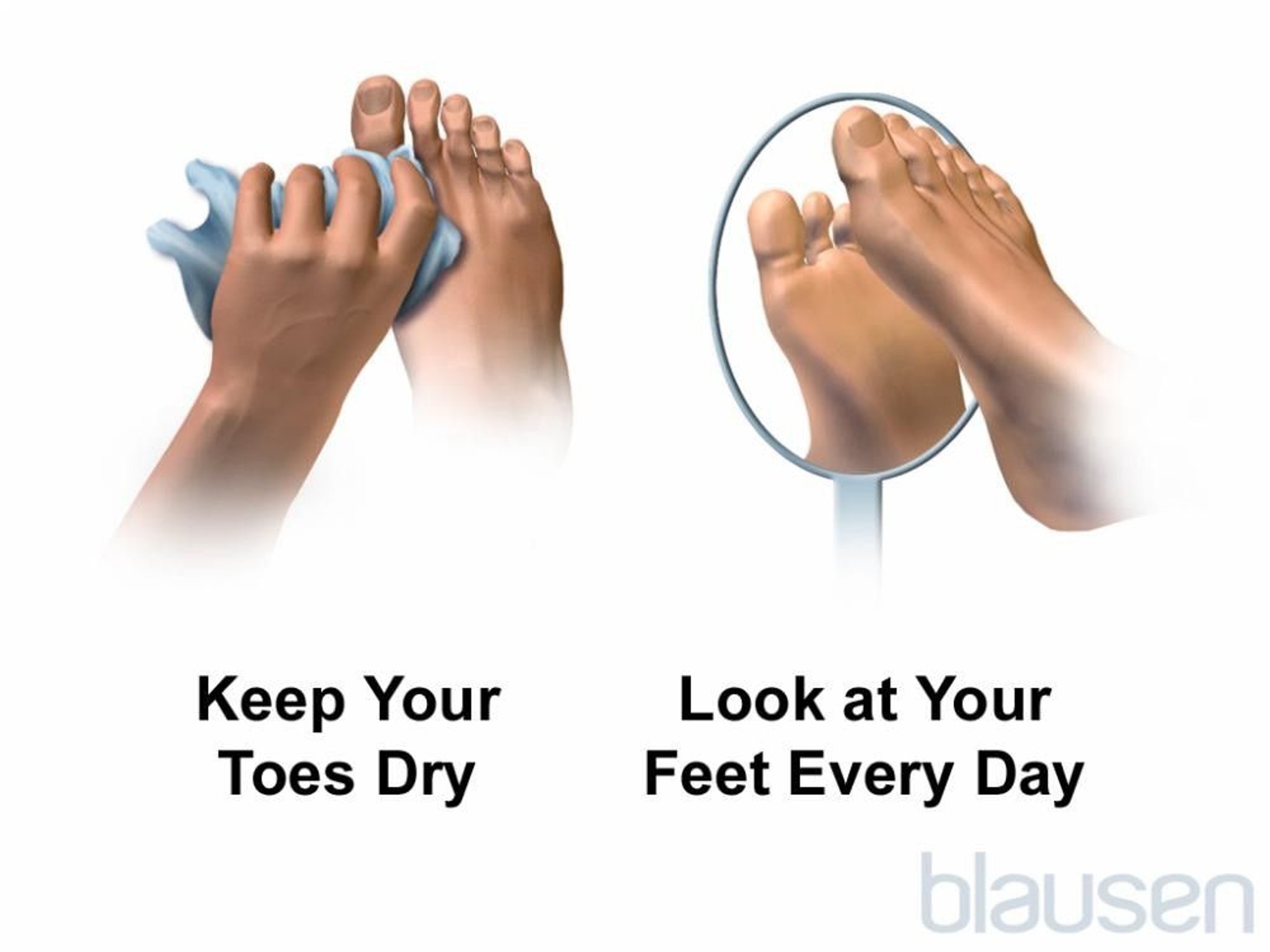 Foot Care for People With Diabetes
