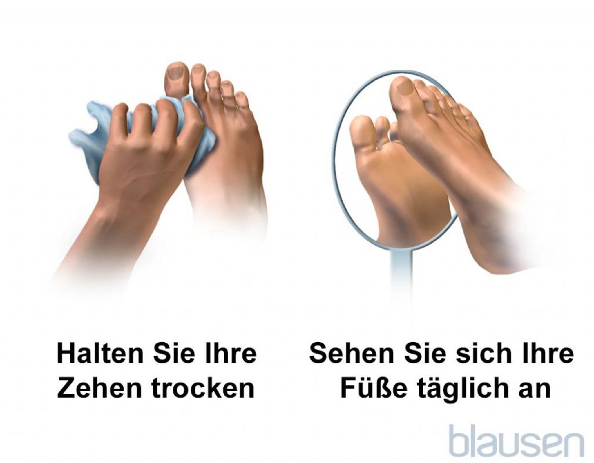 Fußpflege für Diabetiker