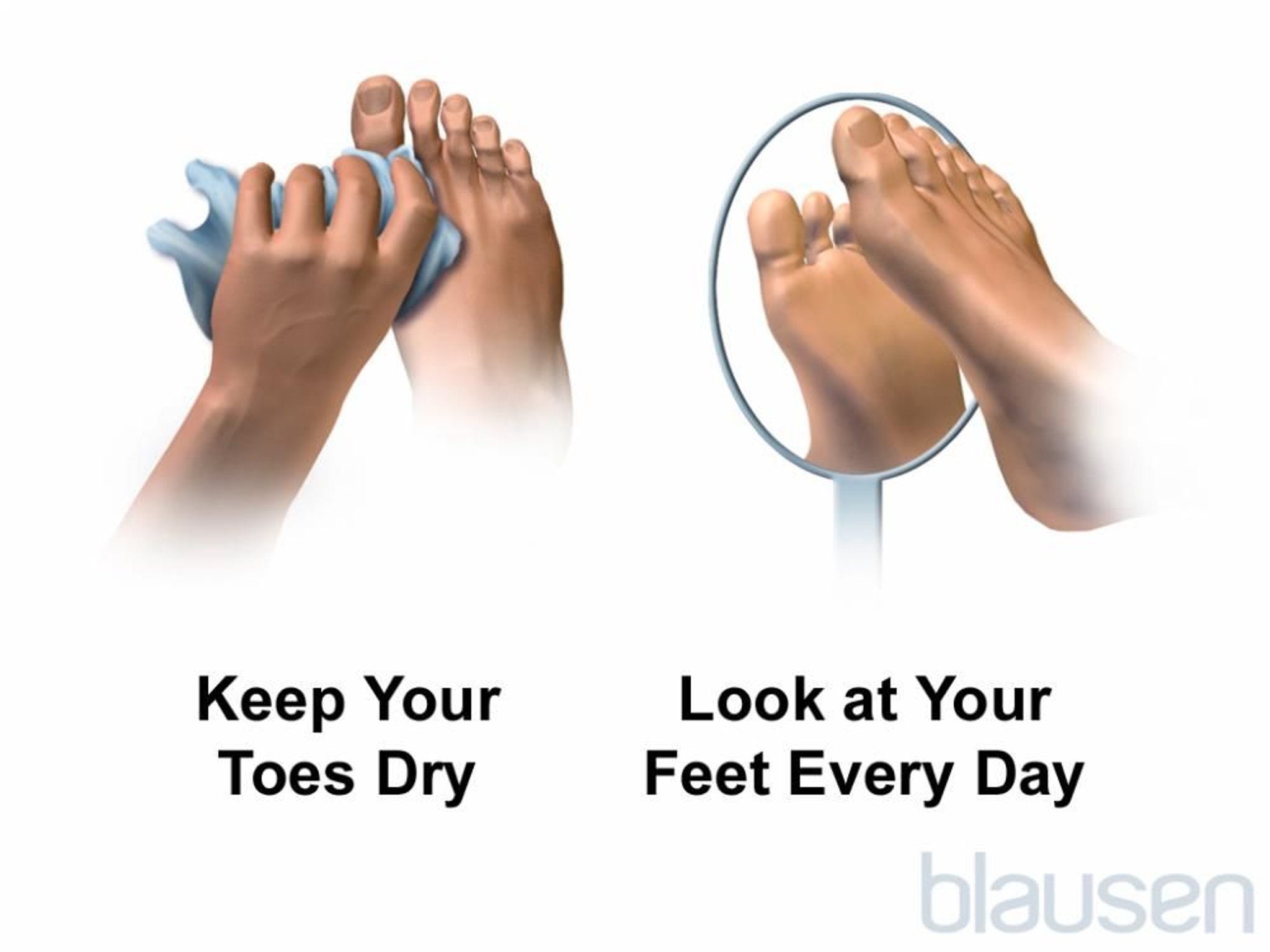 Cuidado del pie para personas con diabetes