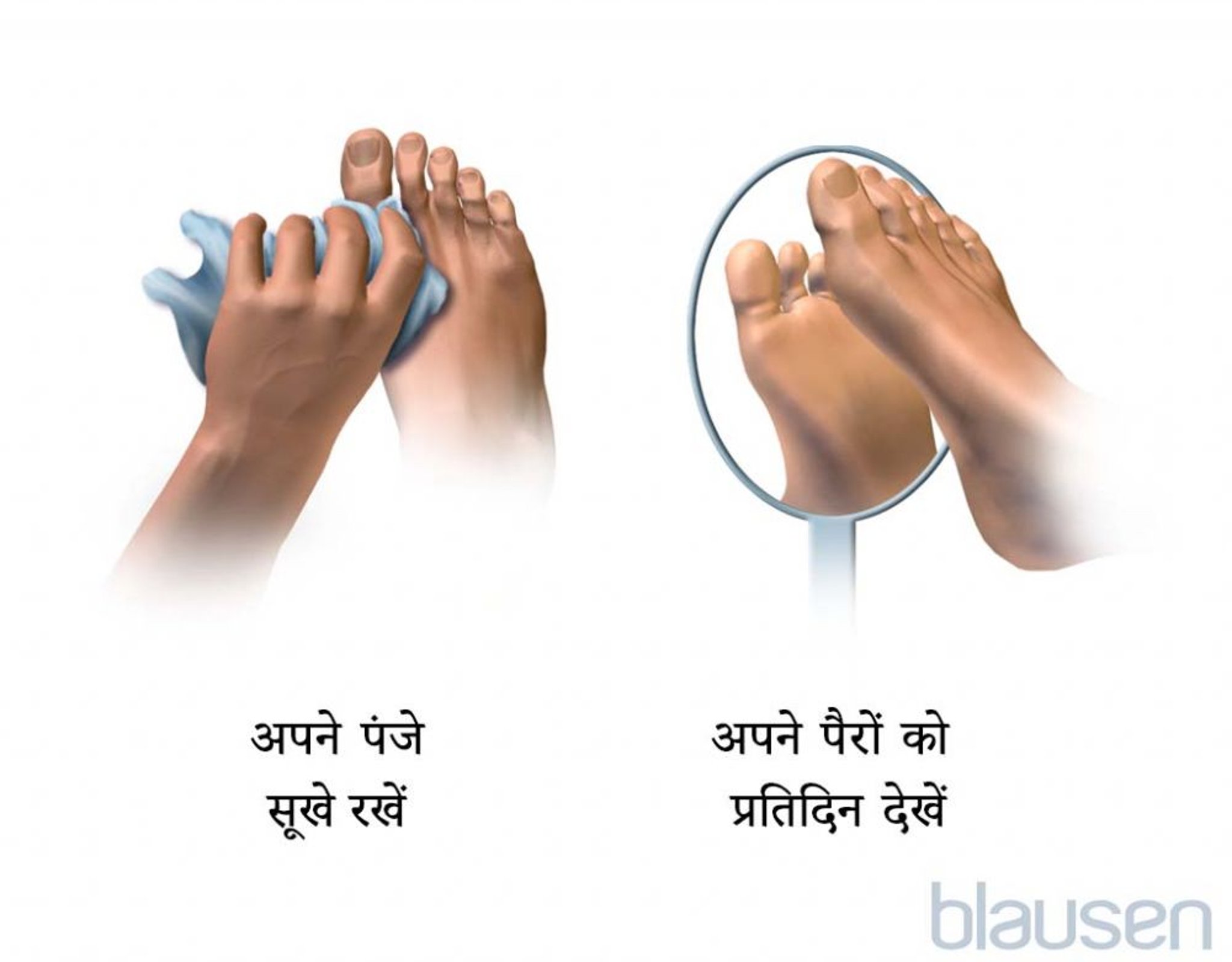 डायबिटीज से पीड़ित लोगों के पैरों की देखभाल