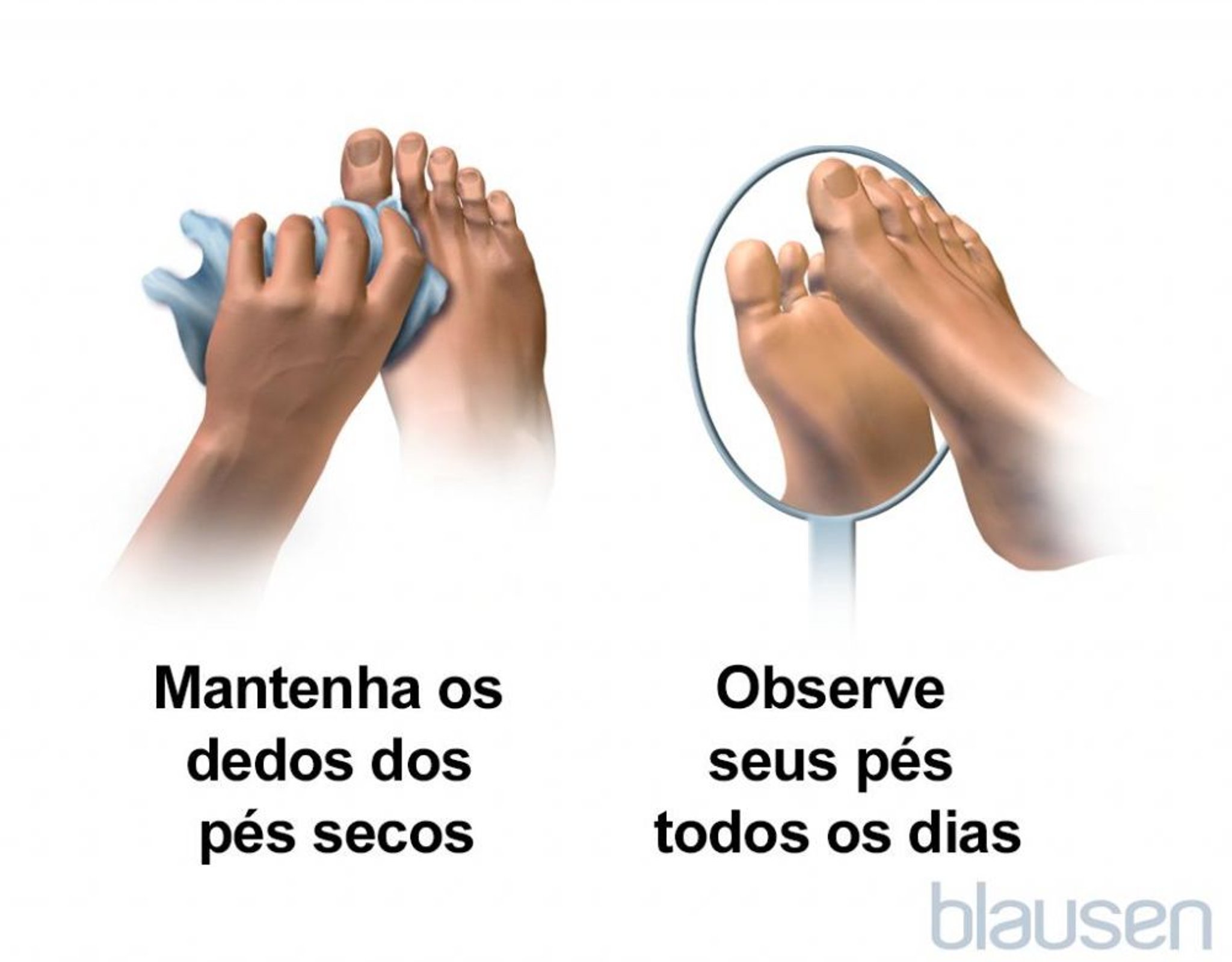 Cuidados com os pés para pessoas com diabetes