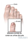 Maneira correta de cortar as unhas dos pés