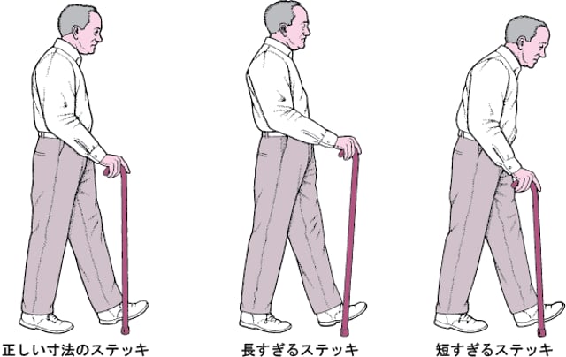 Image:正ただしい寸法ほうに調整ちょうせいする-MSDマニュアル家庭版