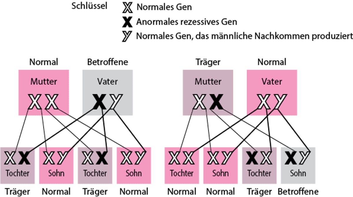 X-gebundene, rezessive Störungen
