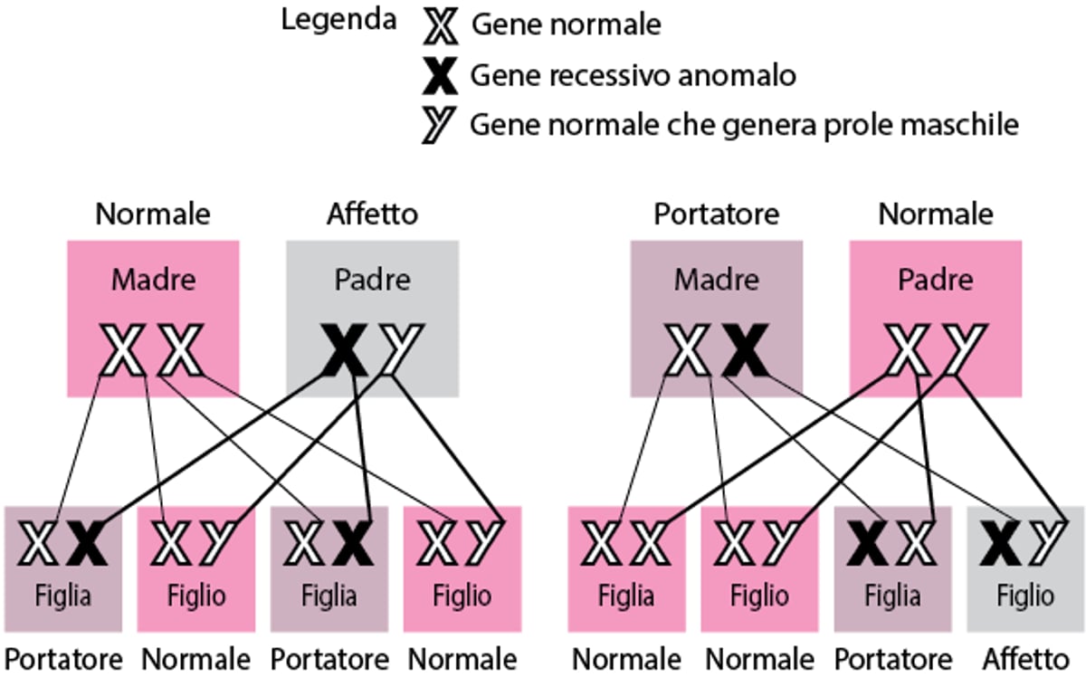Disordini recessivi legati al cromosoma X