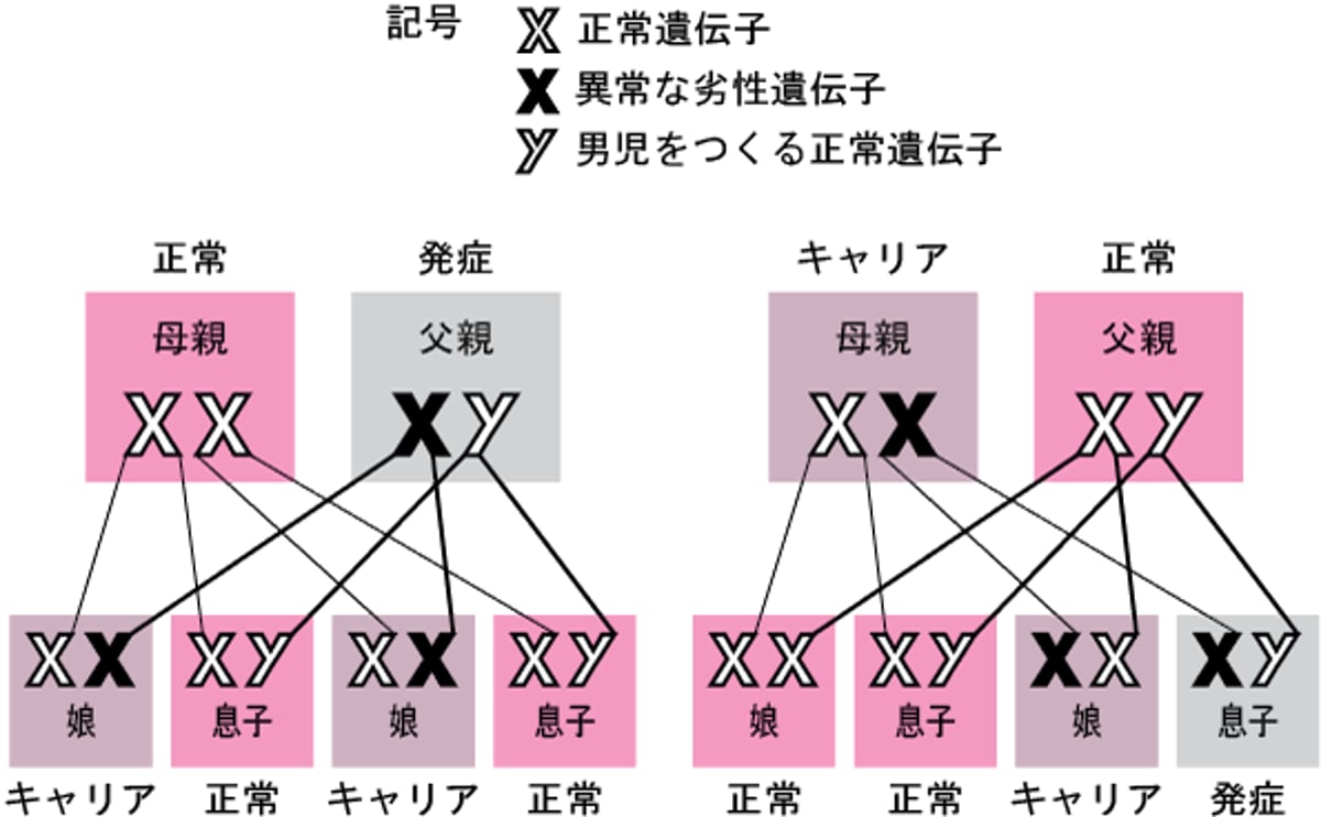 X連鎖劣性遺伝疾患