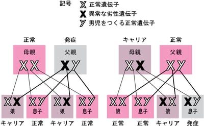X連鎖潜性遺伝（劣性遺伝）疾患