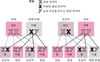 X-연관 열성 질환