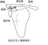 鎖骨さこつの骨折こっせつ