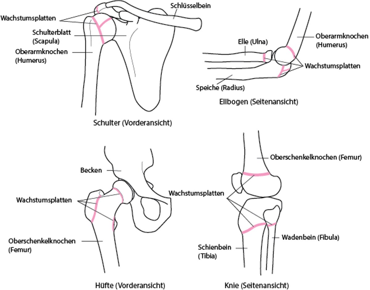 Lokalisierung von Wachstumsfugen