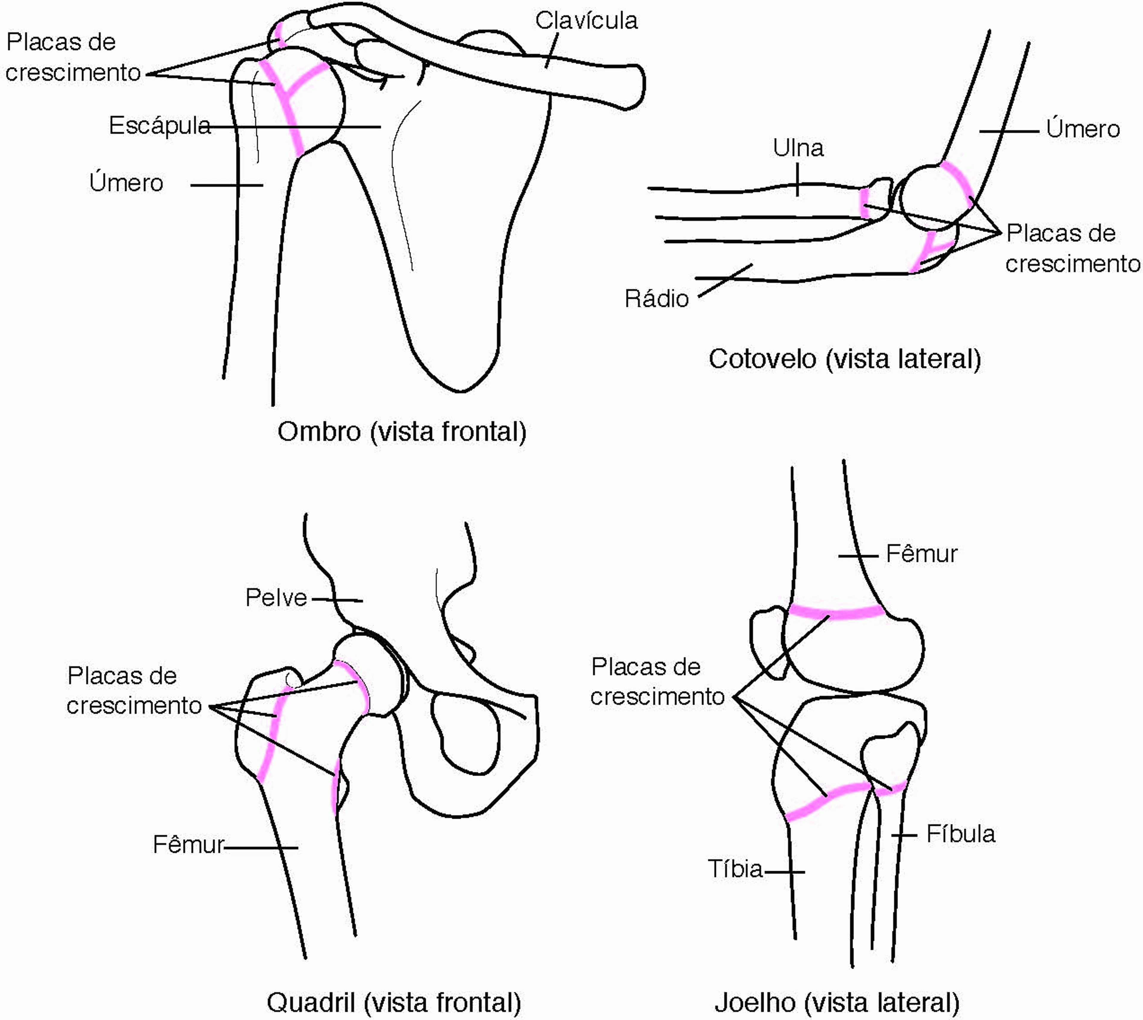 Localização das placas de crescimento