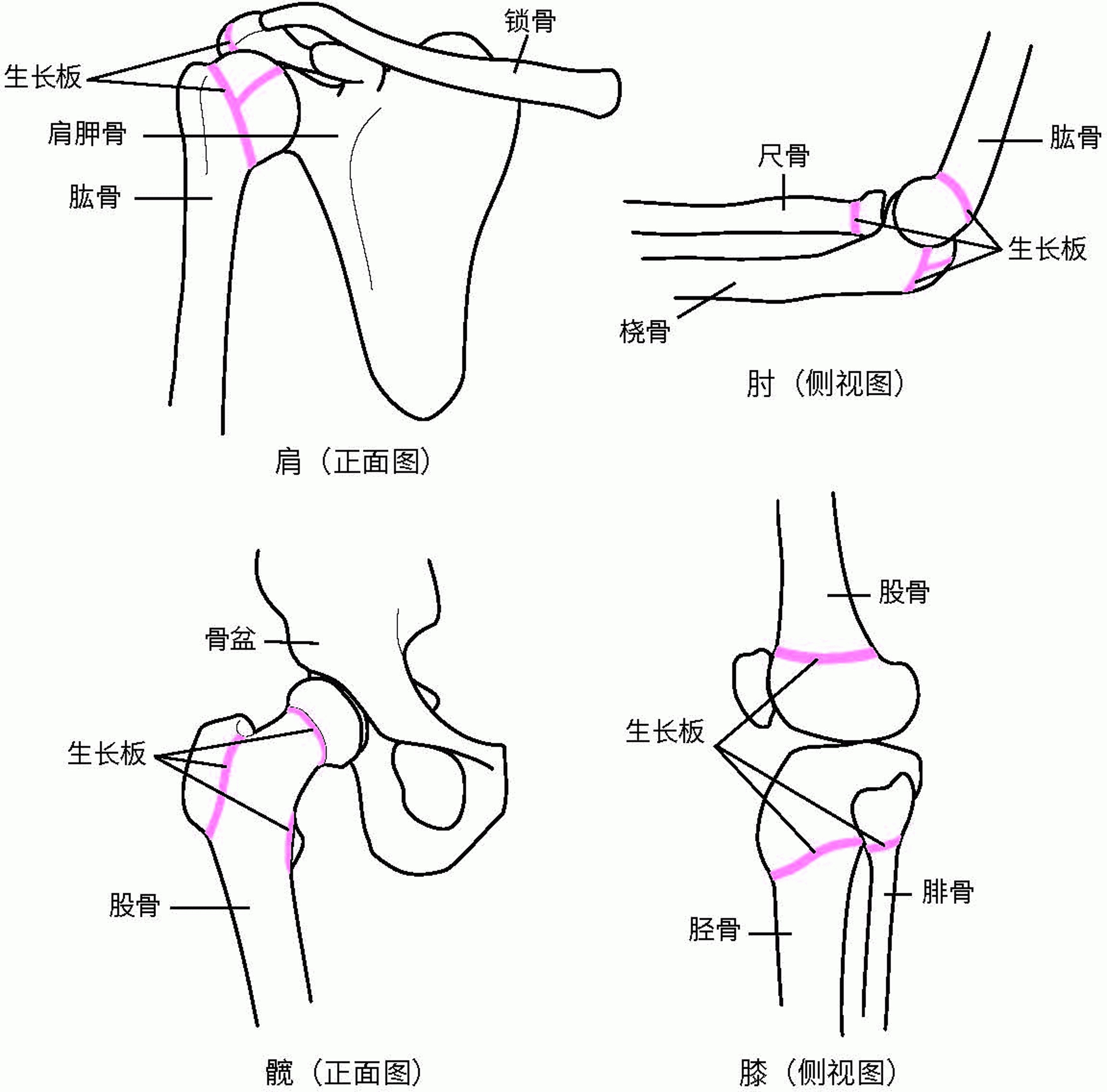 生长板定位