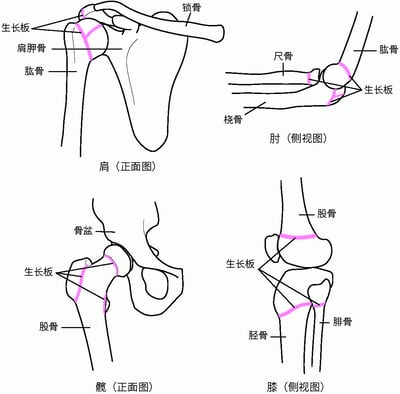 生长板定位