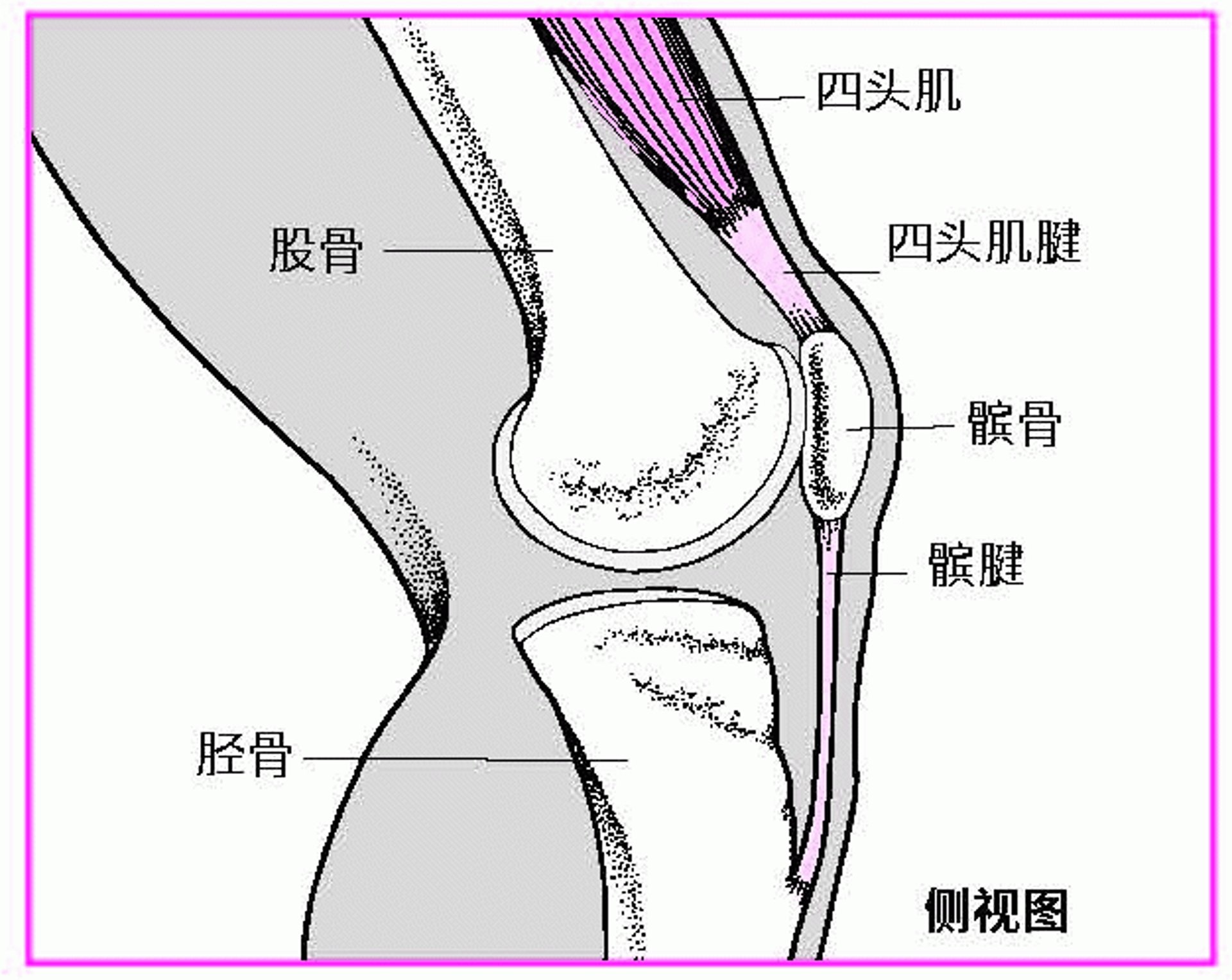 伸直膝关节