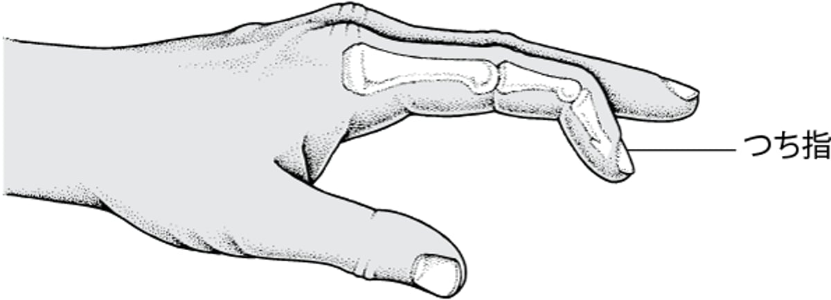 つち<ruby >指<rt >ゆび</rt></ruby>