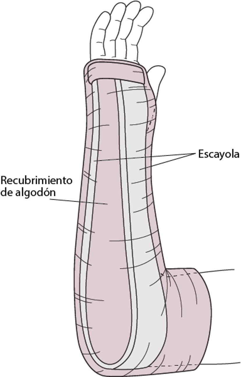 Férula en forma de pinza para el terrón de azúcar