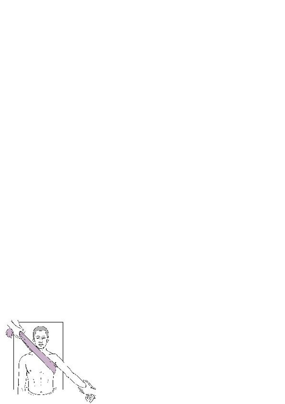 Einrenken einer Schulter: Traktion-Gegentraktion