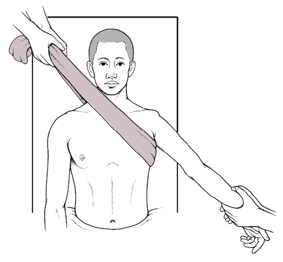 Reducción de la luxación de hombro: tracción-contratracción