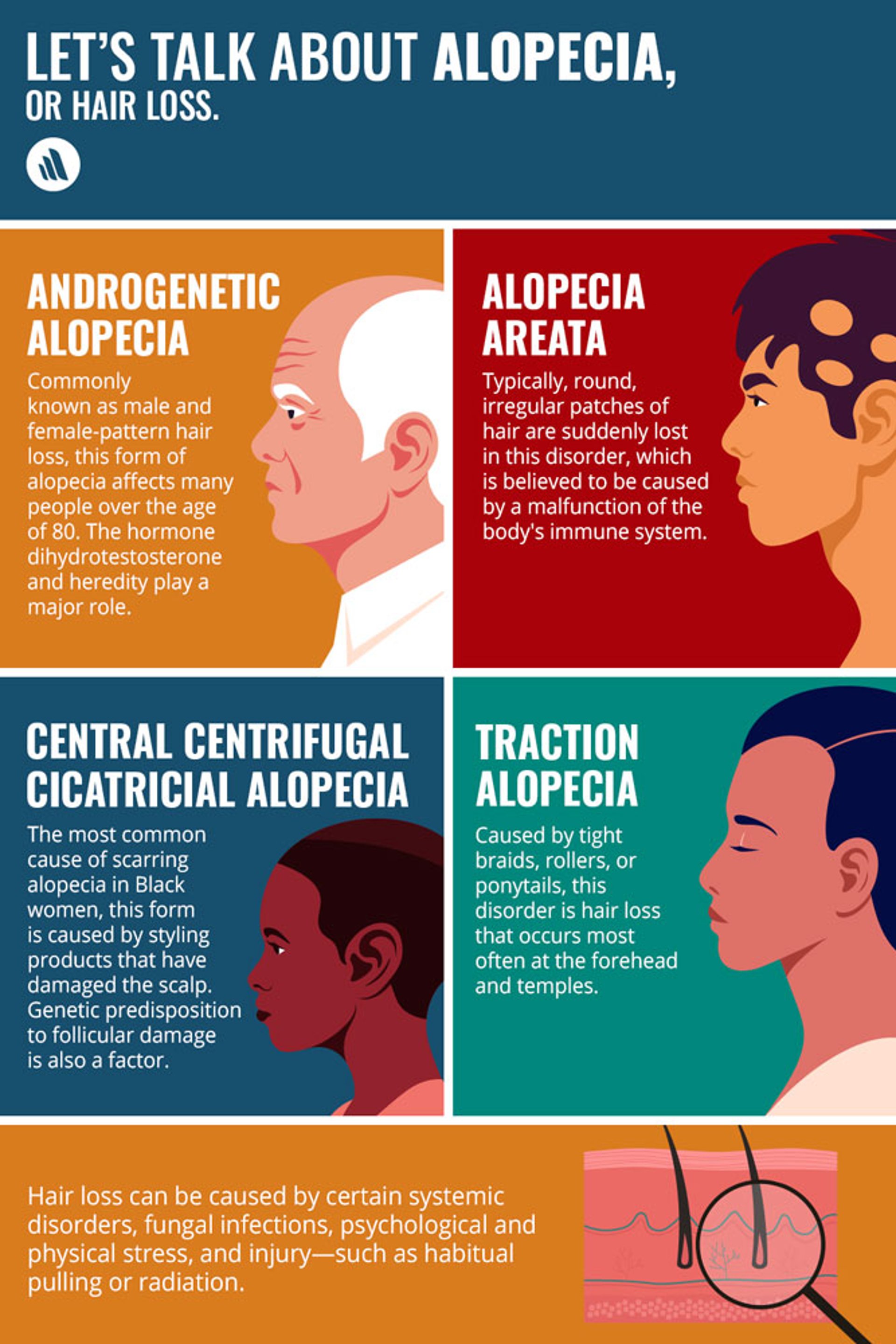 Some Causes of Alopecia (Hair Loss)