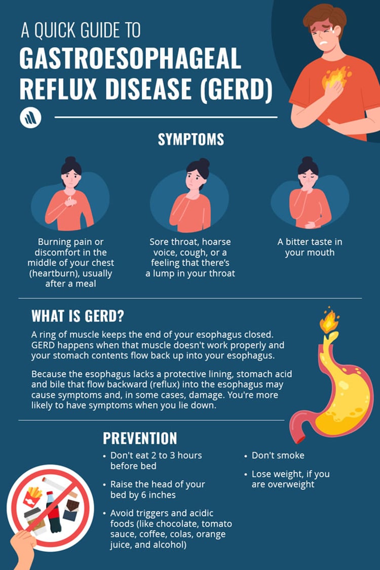 Gerd Doctor Quick Facts:Gastroesophageal Reflux Disease (GERD) - Merck Manual ...