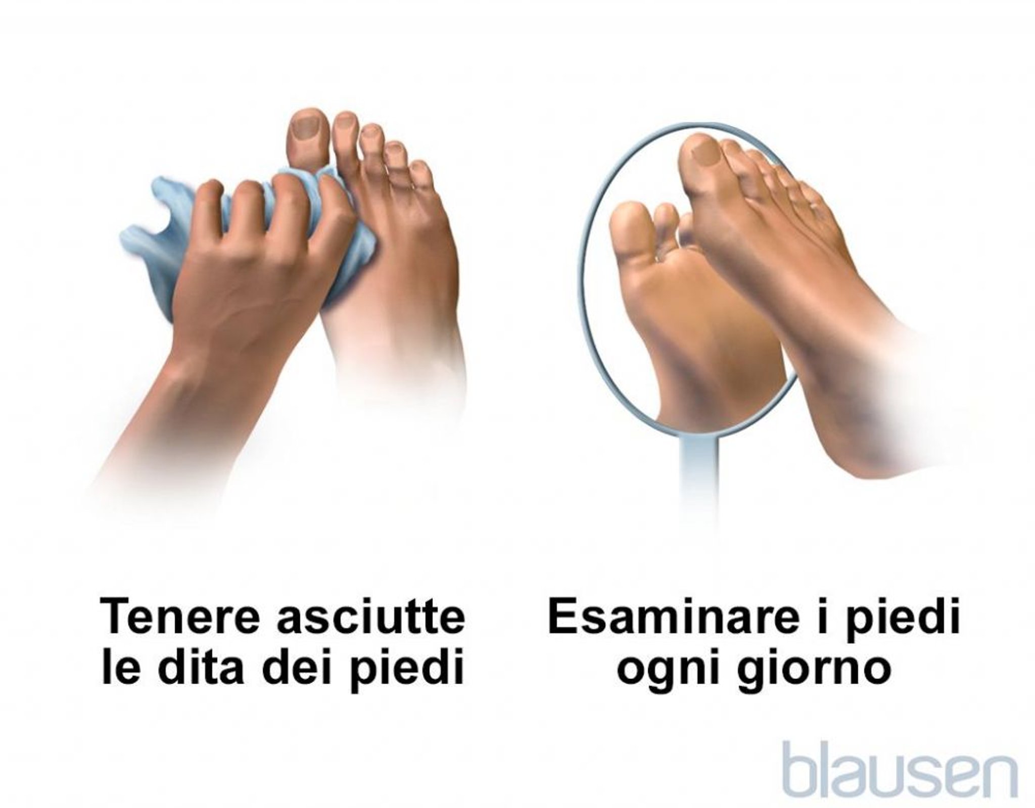 Cura dei piedi per le persone con diabete