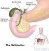 The Gallbladder and Bile Ducts