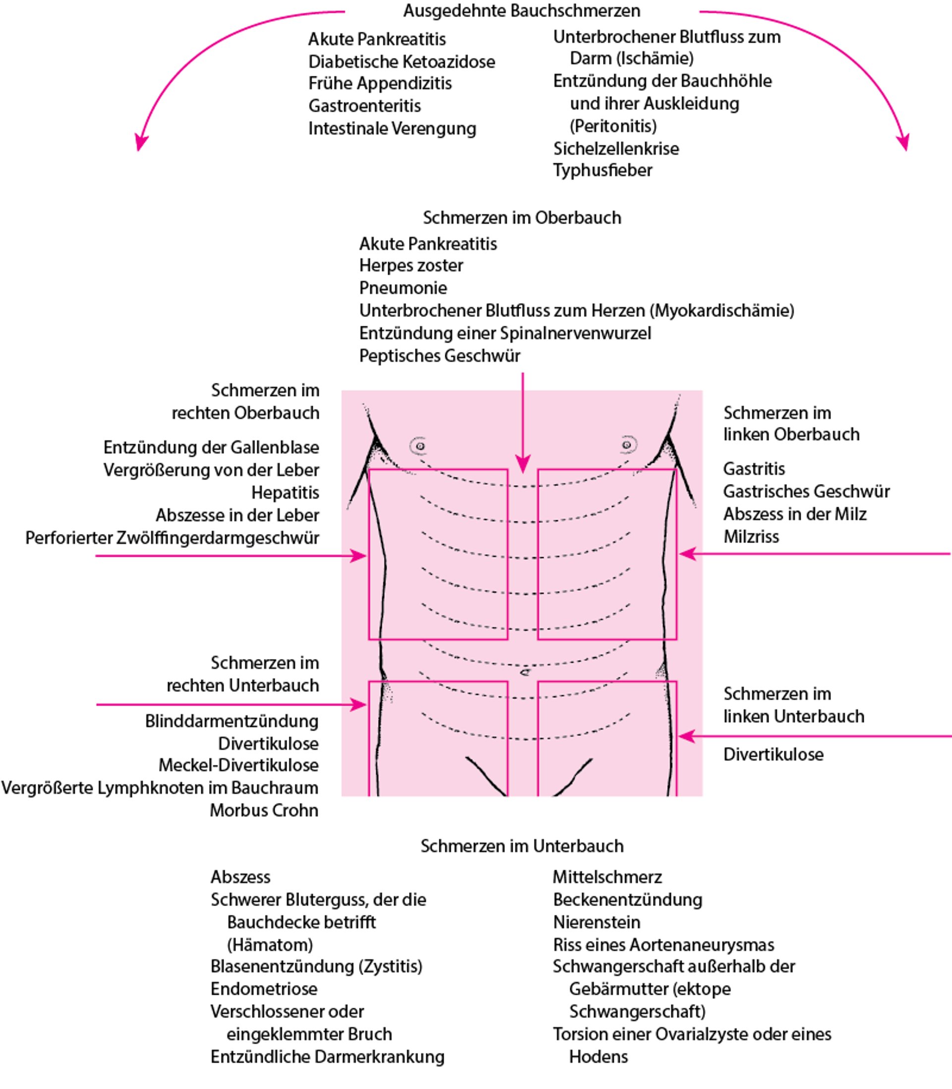 Ursachen für Bauchschmerzen nach Lokalisation