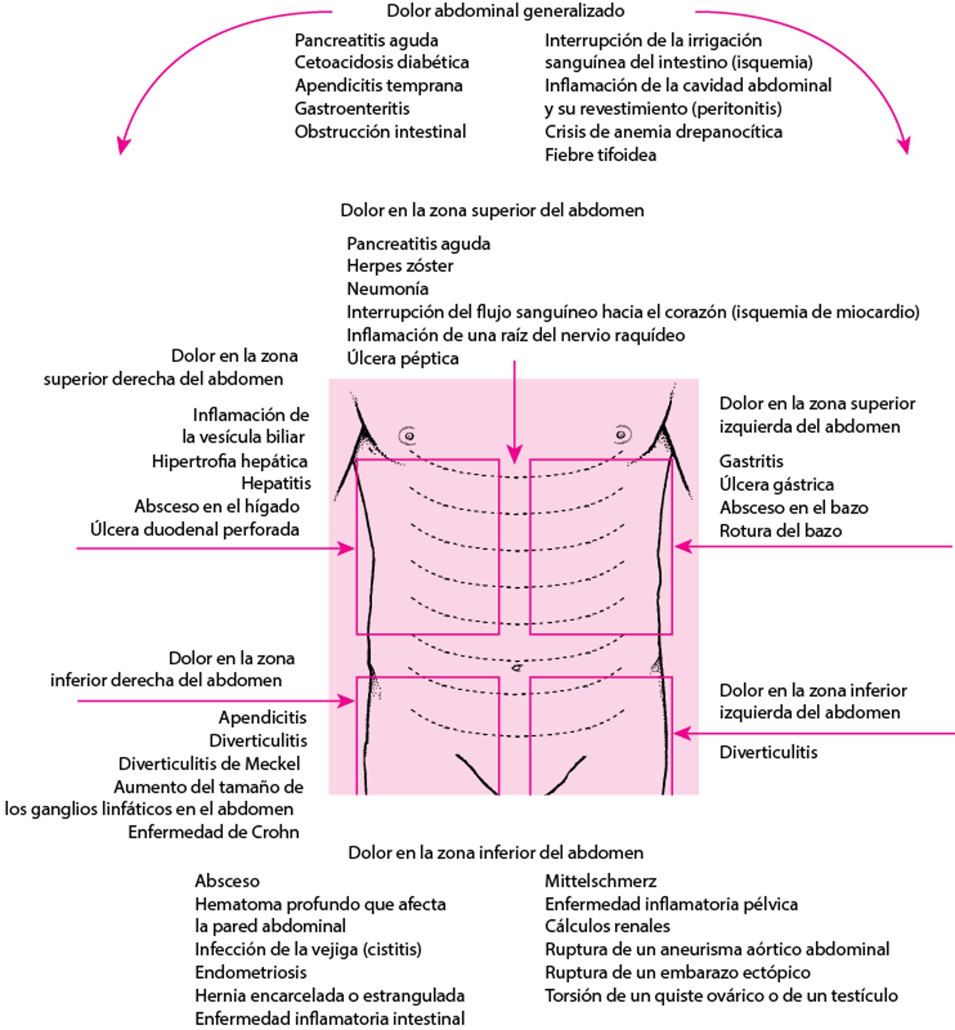 Causas del dolor abdominal por localización