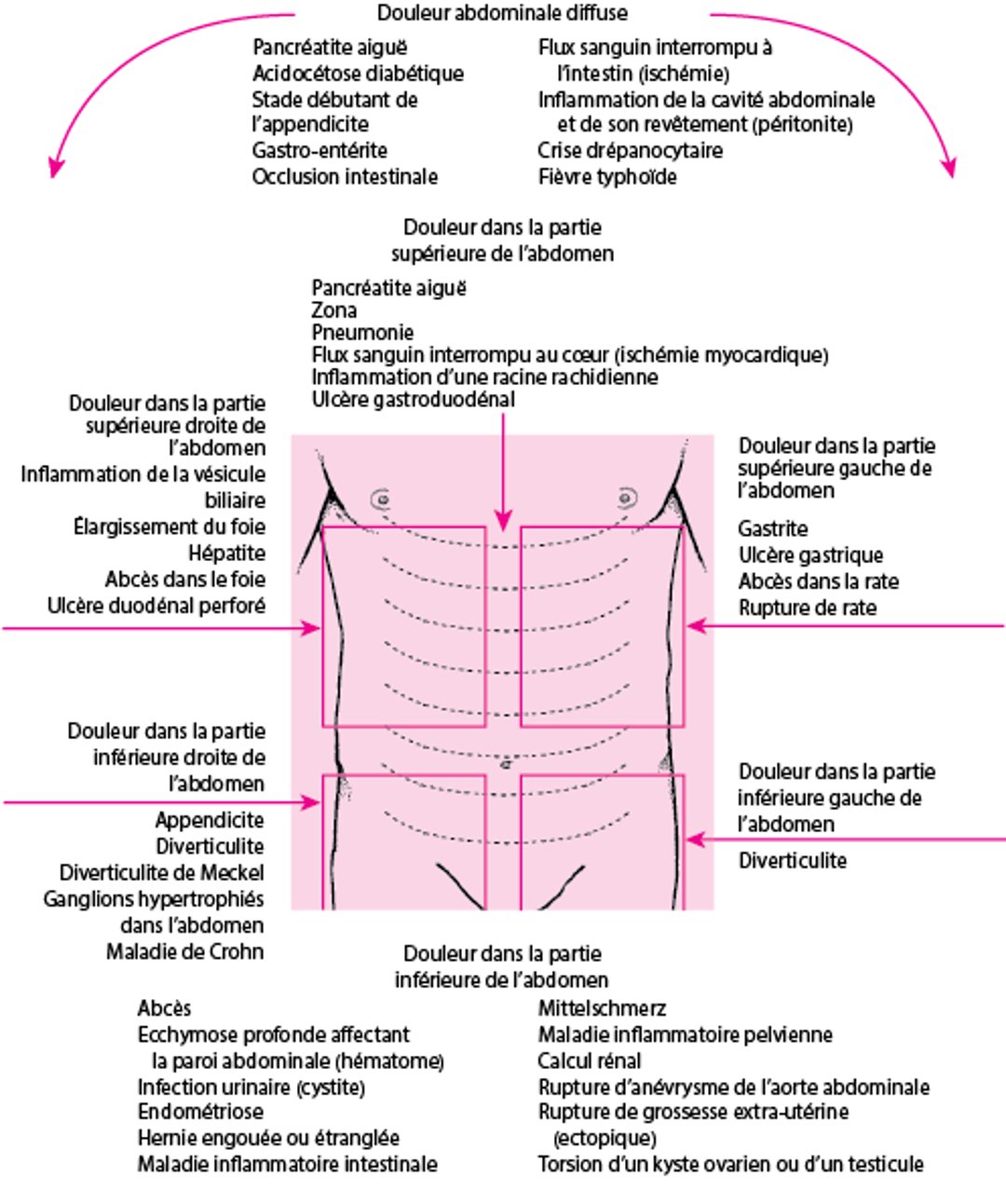 Causes de la douleur abdominale suivant l’emplacement