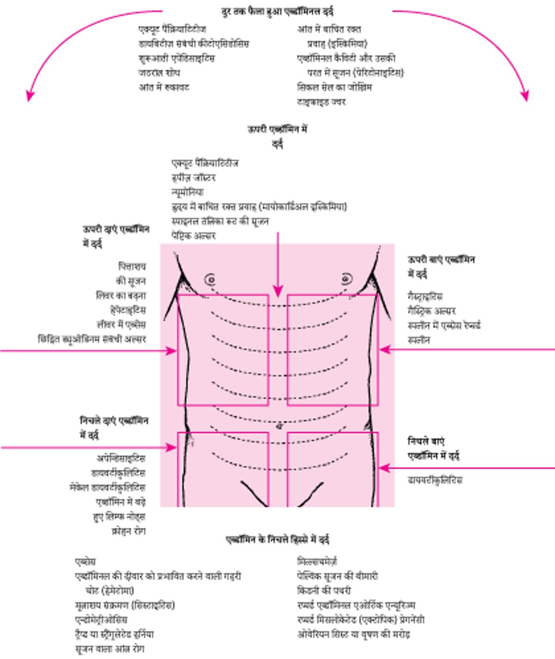 स्थान के हिसाब से पेट दर्द के कारण