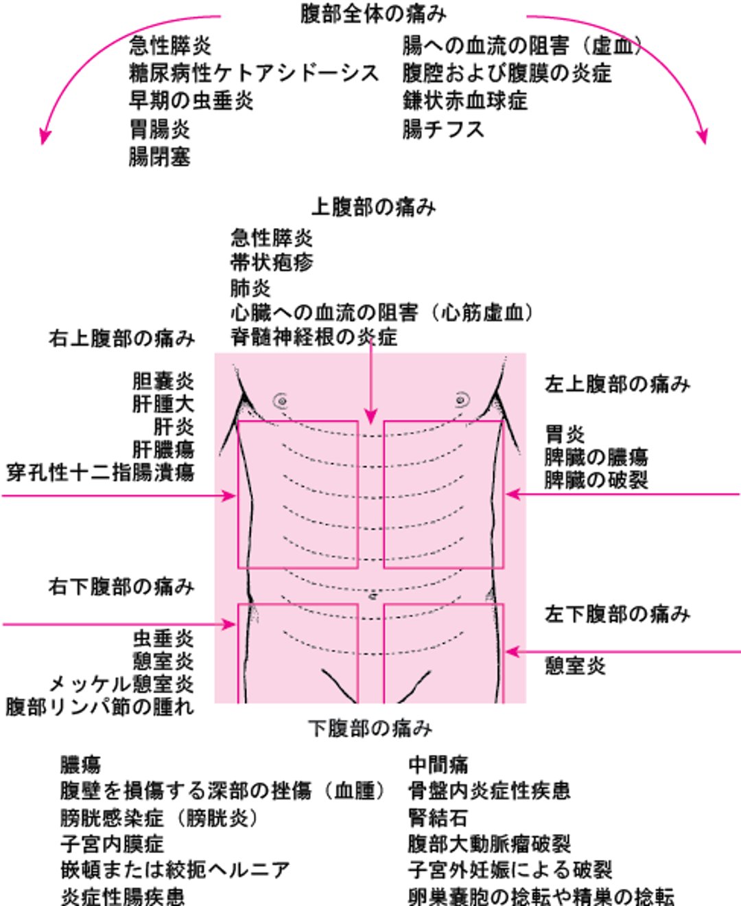 腹痛の位置別の原因
